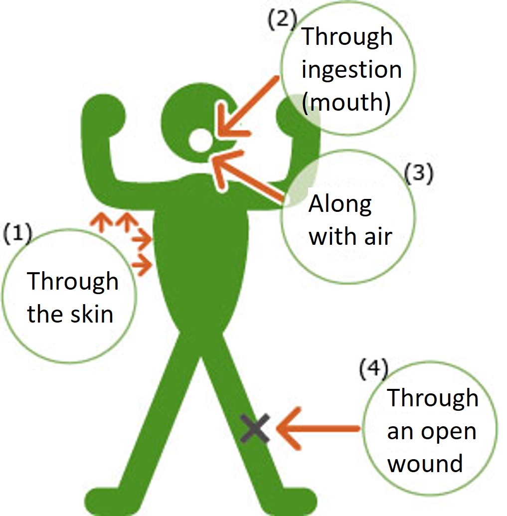 Internal radiation exposure